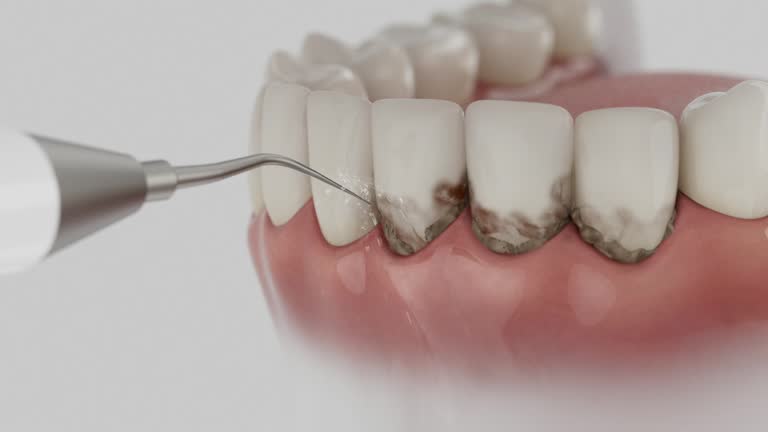 Trusted Dental Implants service in Everett, PA - Dentist Open Now